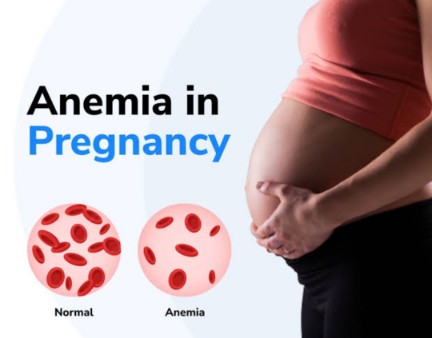 Screening and Diagnosis of Iron-Deficiency Anemia in Pregnancy