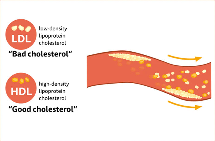 The Essential Cholesterol Meter: Pathway to Heart Health